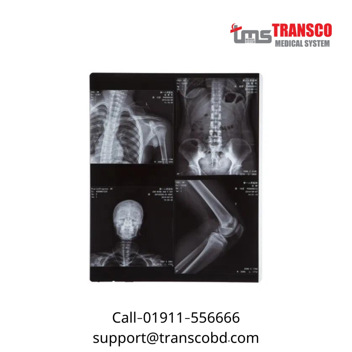 14*17 Inch Agfa Medical Dry Film